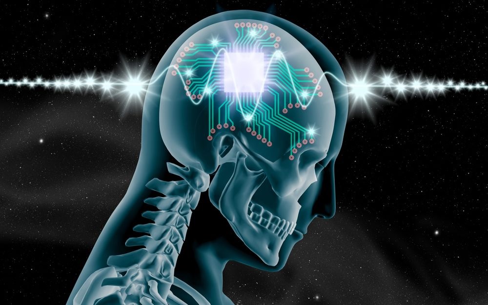 Brain implant Brain implant